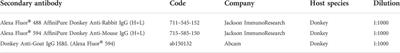 Increased CD34 in pancreatic islet negatively predict islet β-cell decrease in type1 diabetes model